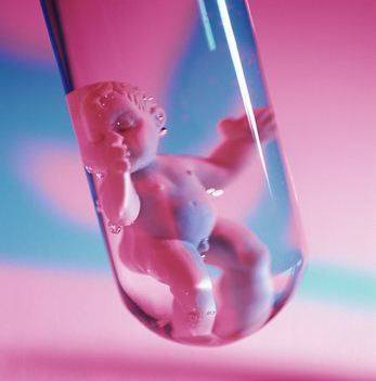 体外受精 IVF-ET